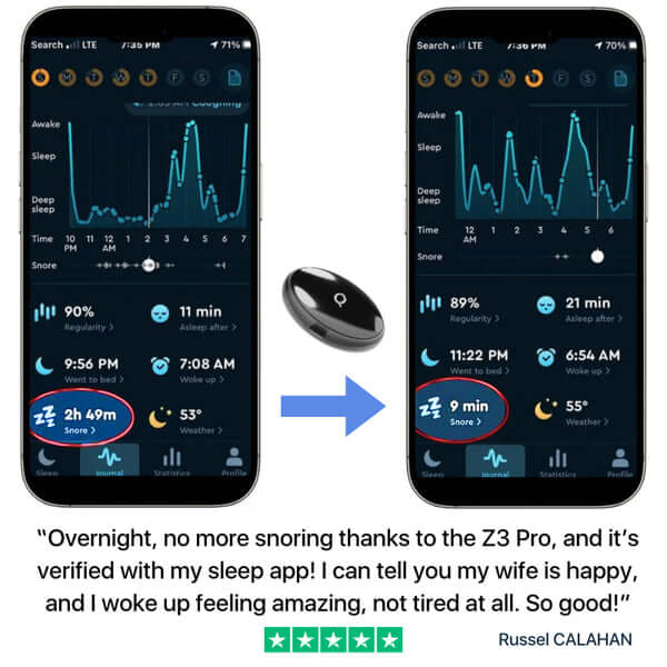 Z3 Pro® | Smart EMS Sleep Device
