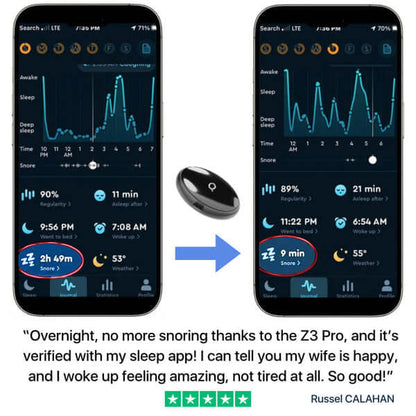 Z3 Pro® | Smart EMS Sleep Device