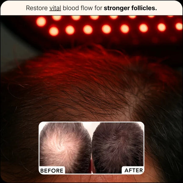 Fuller Hair in 6 Weeks